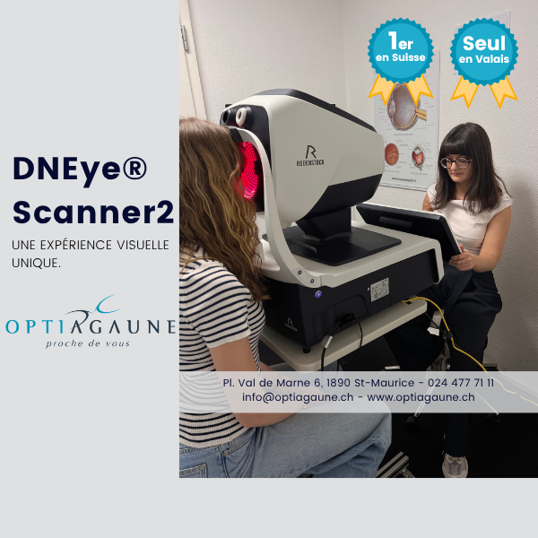 Agaune DNEye Scanner2 avec notre photo